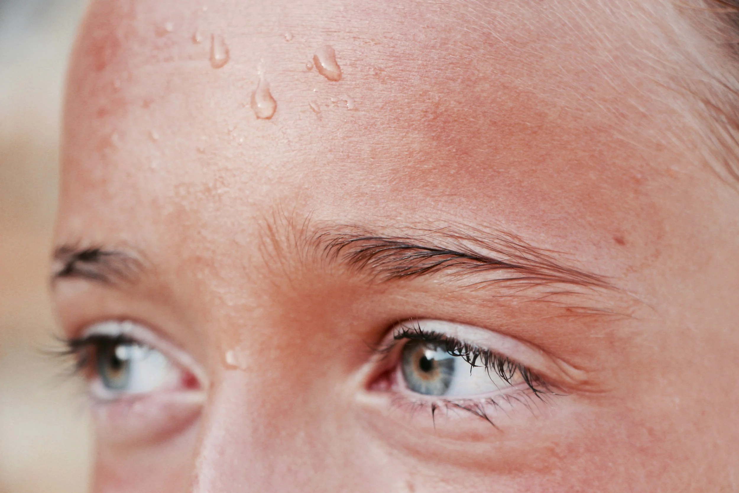 Primer plano de una frente con gotas de sudor por el calor del verano, piel sensible y enrojecida
