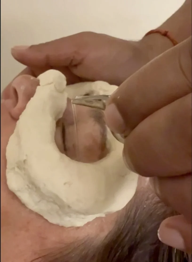 Terapia ocular ayurvédica Akshi Tarpan con ghee medicinal