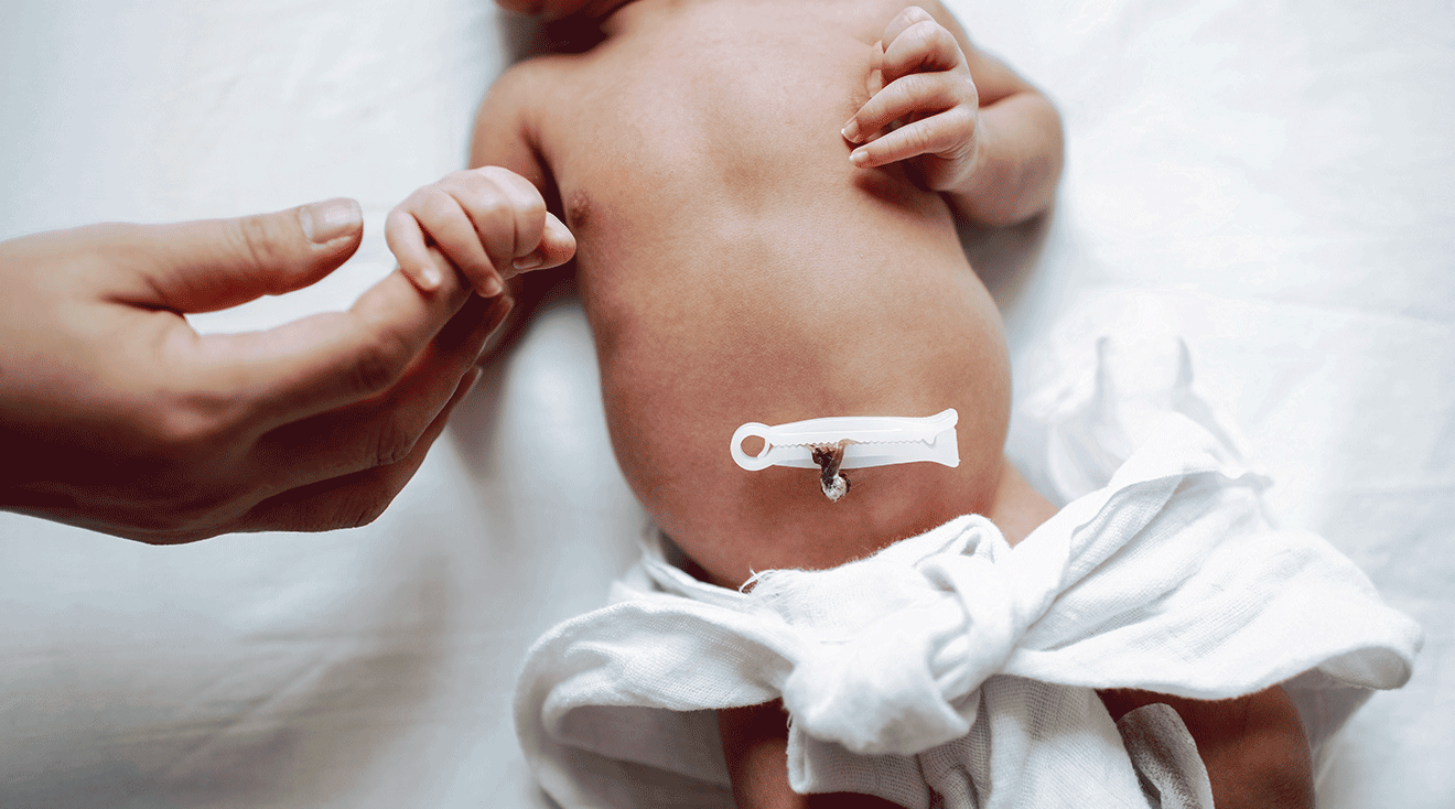 The Timing of Umbilical Cord Clamping: What to Know