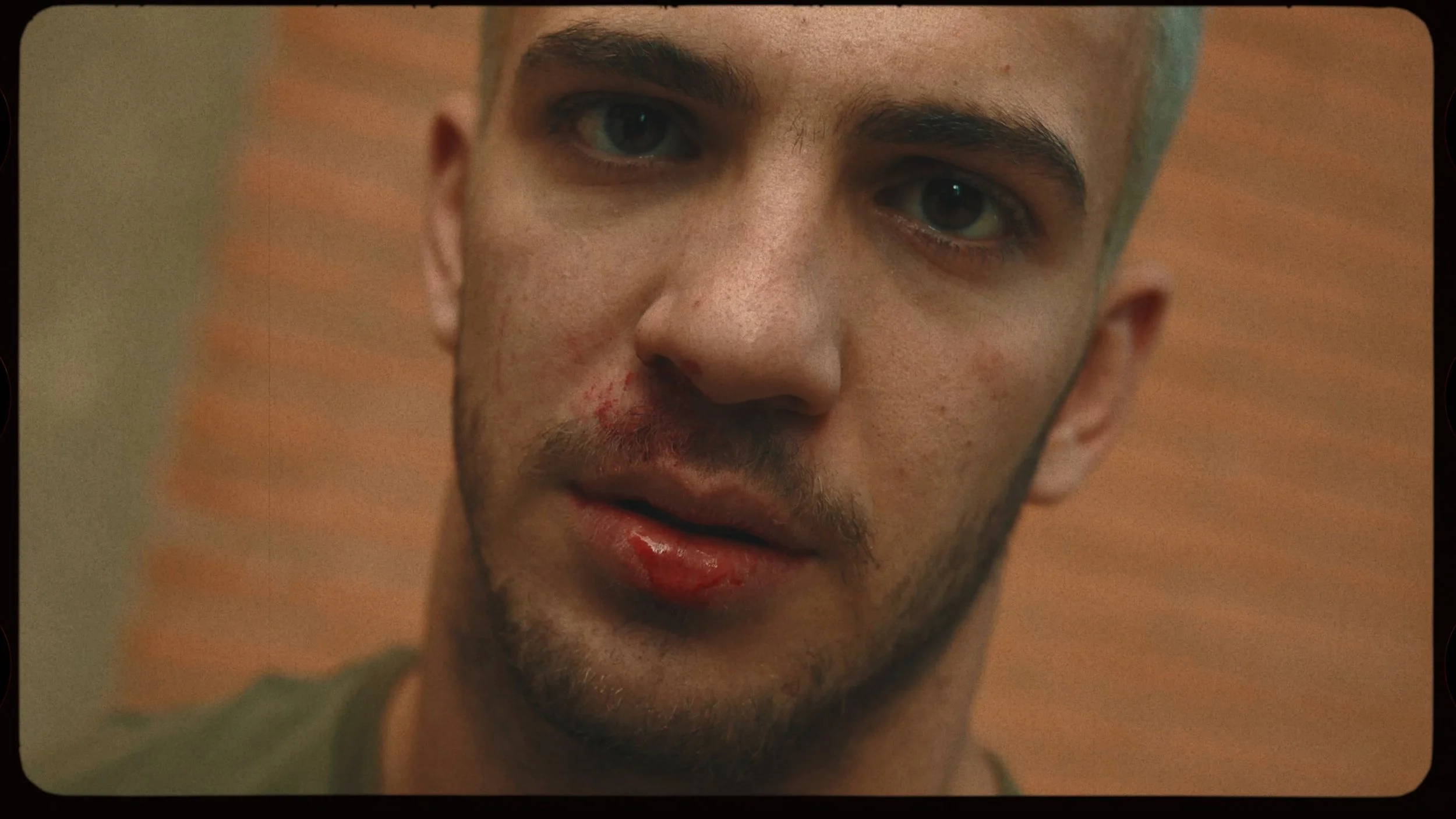 Close-up of a young man with short hair, facial injuries including a bloodied lip and bruises, looking directly at the camera.