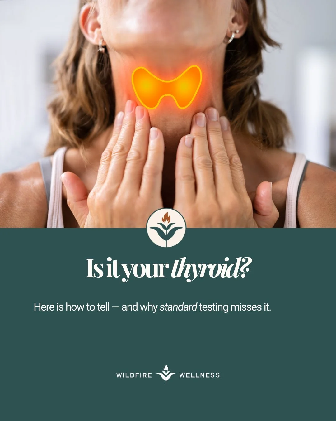 You were told your thyroid is fine.

But "fine" was based on one number: TSH. That's it. One data point from a panel that can run six.

TSH tells us what your pituitary is asking for. It doesn't tell us what your cells are actually getting.