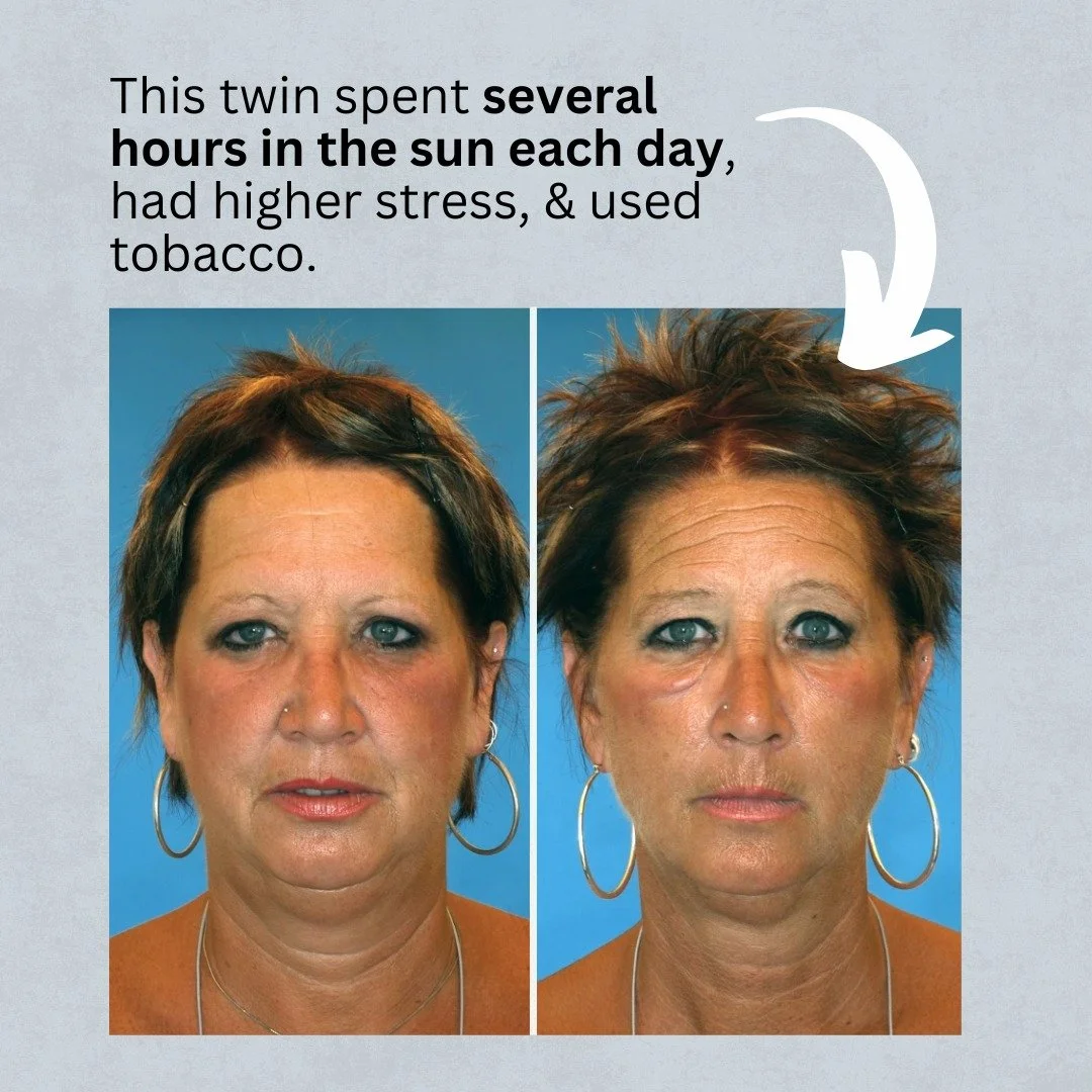Today is National Sibling Day! 
One of our fav studies relevant to Dermatology is the "Twin Study" . Led by Dr. Guyuron in 2009, this study analyzed the effects of lifestyle choices on the aging process, providing evidence of how even with 