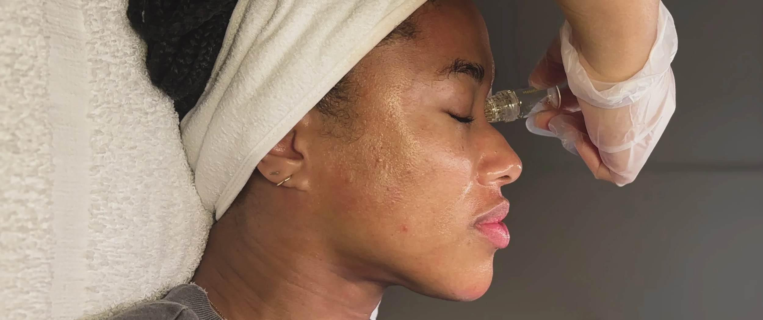 Get Sculpted: Discover the Jawline Botox Nefertiti Lift