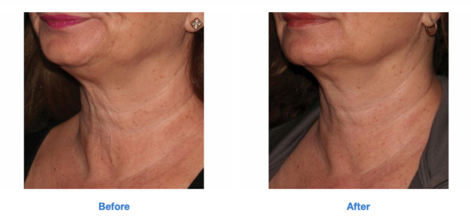 Screen Shot 2022-09-13 at 10.39.13 PM.png