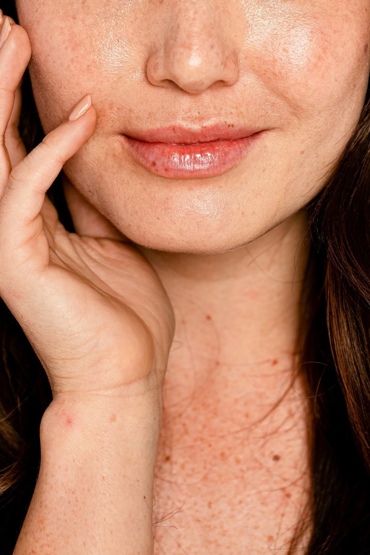 Cosmetic Injectables: Dermal Filler, Facial Balancing, Anti-Wrinkle Injections Dysport Botox Xeomin NucievaInjections