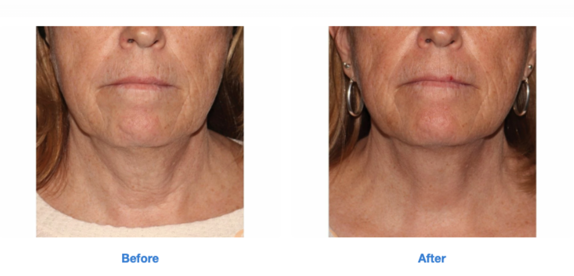 Screen Shot 2022-09-13 at 10.40.02 PM.png