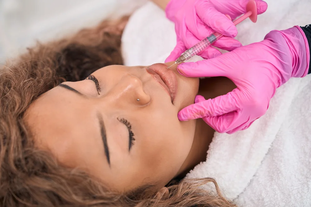 Dermal filler facial contouring