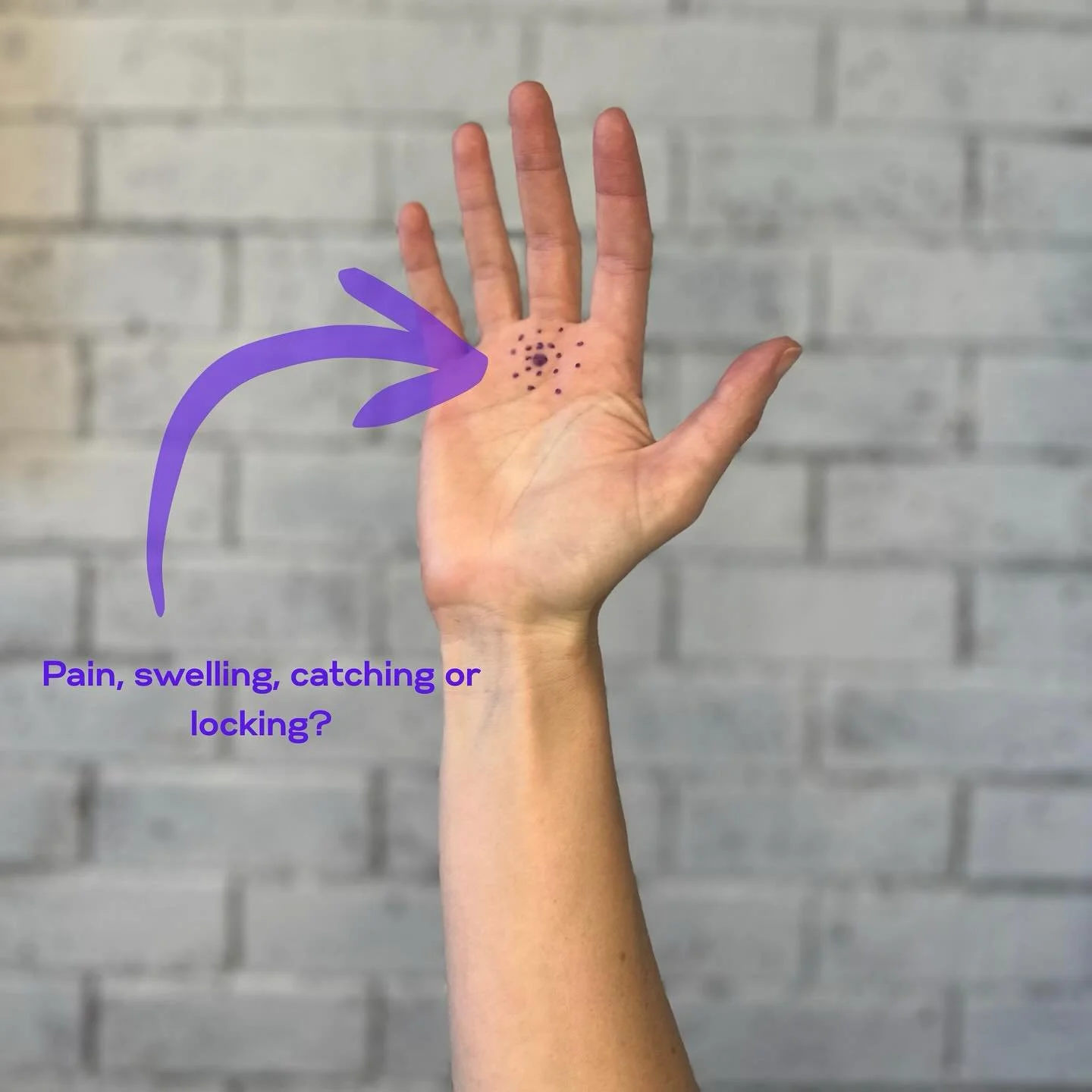 Have you got a finger that catches or locks? Hand therapy could help. Follow @regionalacutecare for more info. #handphysio #handpain #lockingfinger