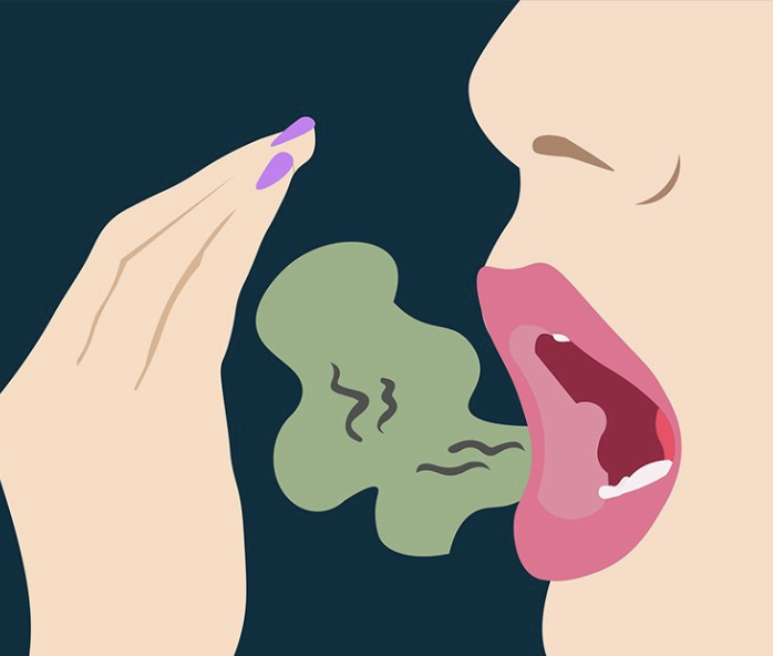 What Causes Bad Breath?