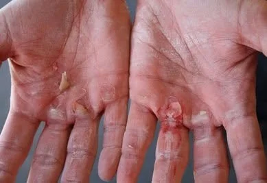 Day 4...................