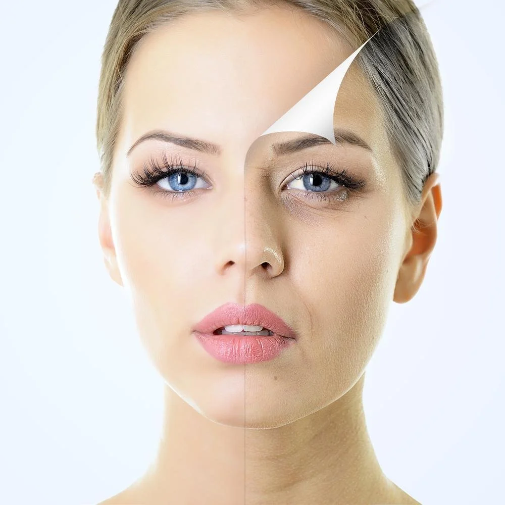 A portrait of a woman with half of her face showing before cosmetic treatment and the other half after.