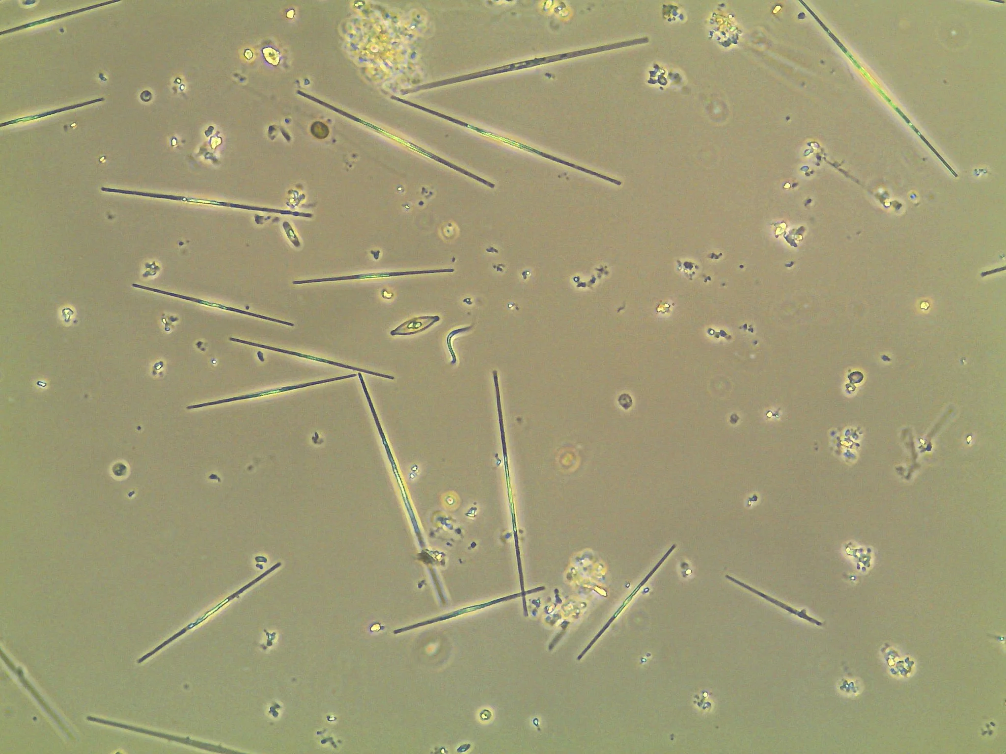 Is algae the villain — or the victim — of a warming Muskoka?