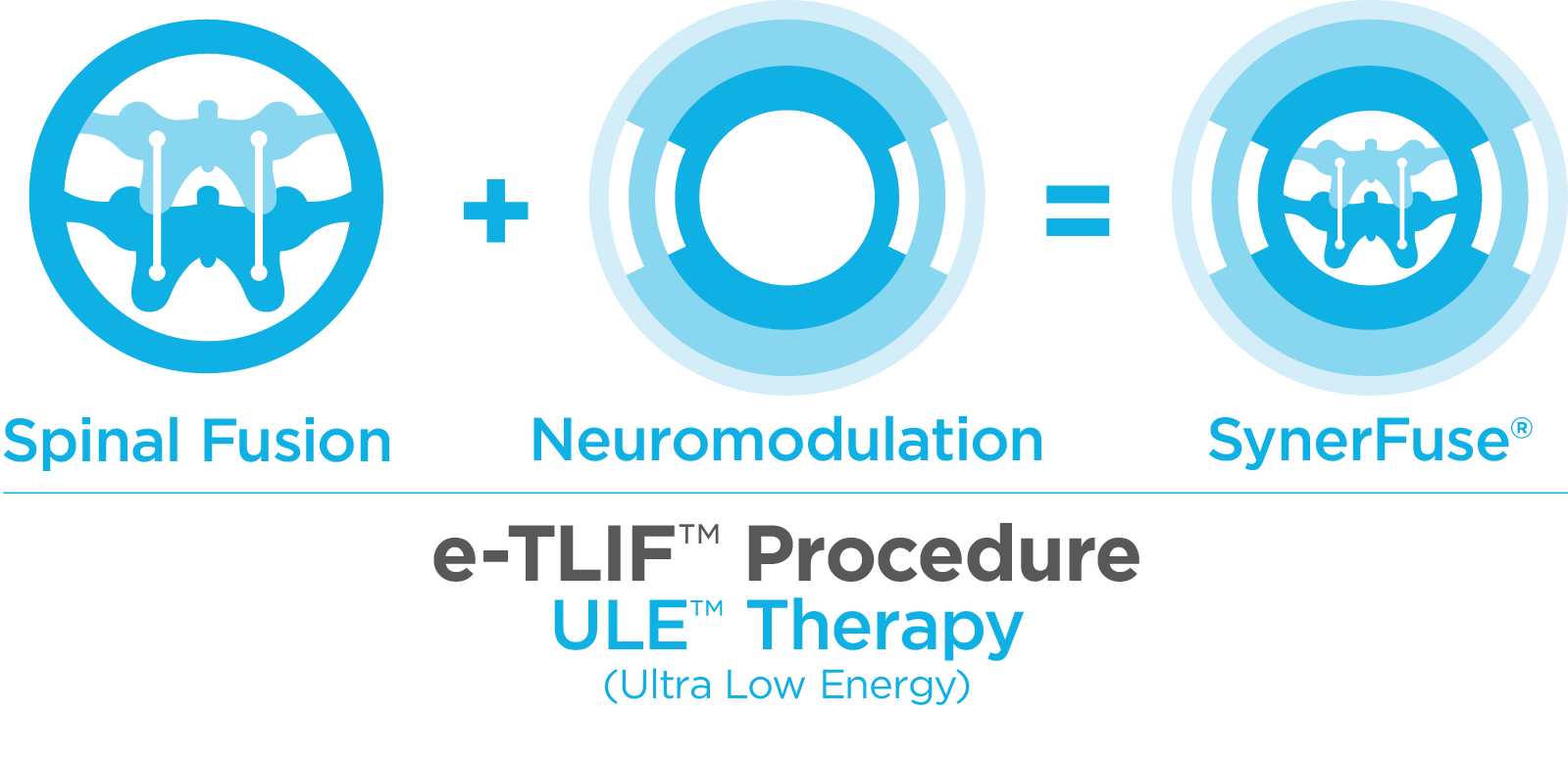 SynerFuse e-TLIF Procedure Graphic