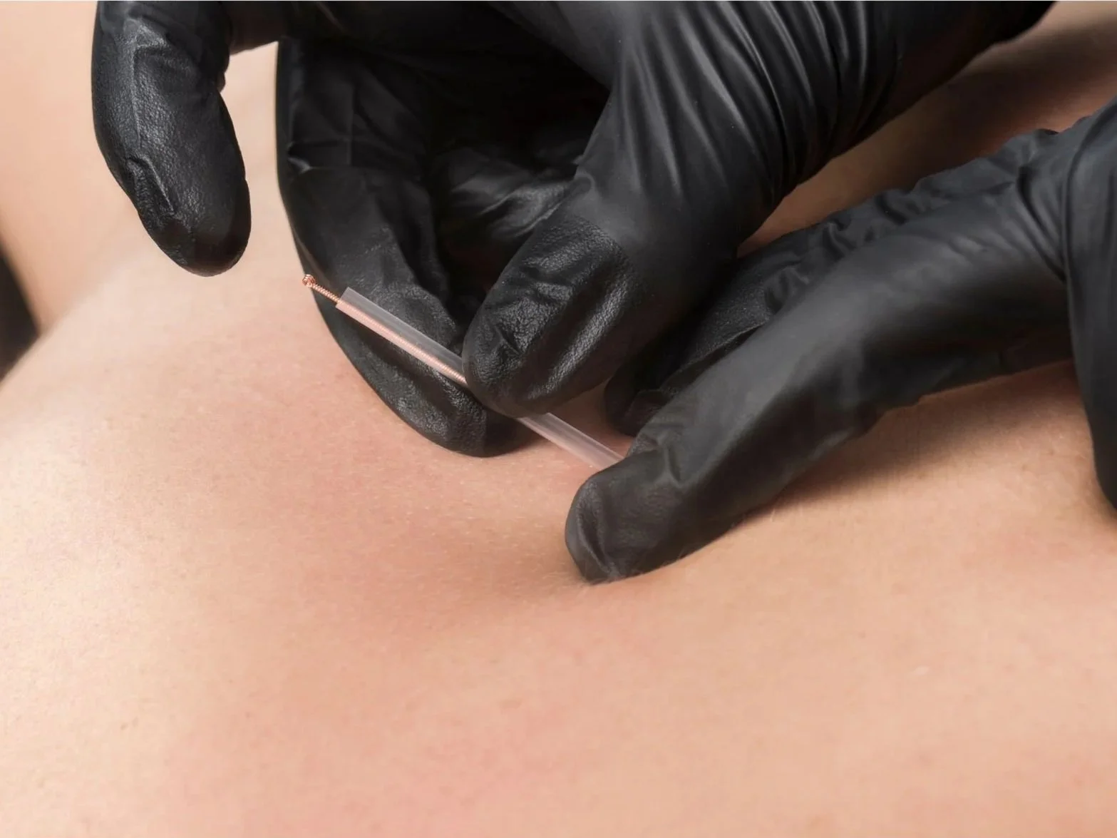 Physician using gloves to insert a needle into skin of patient.
