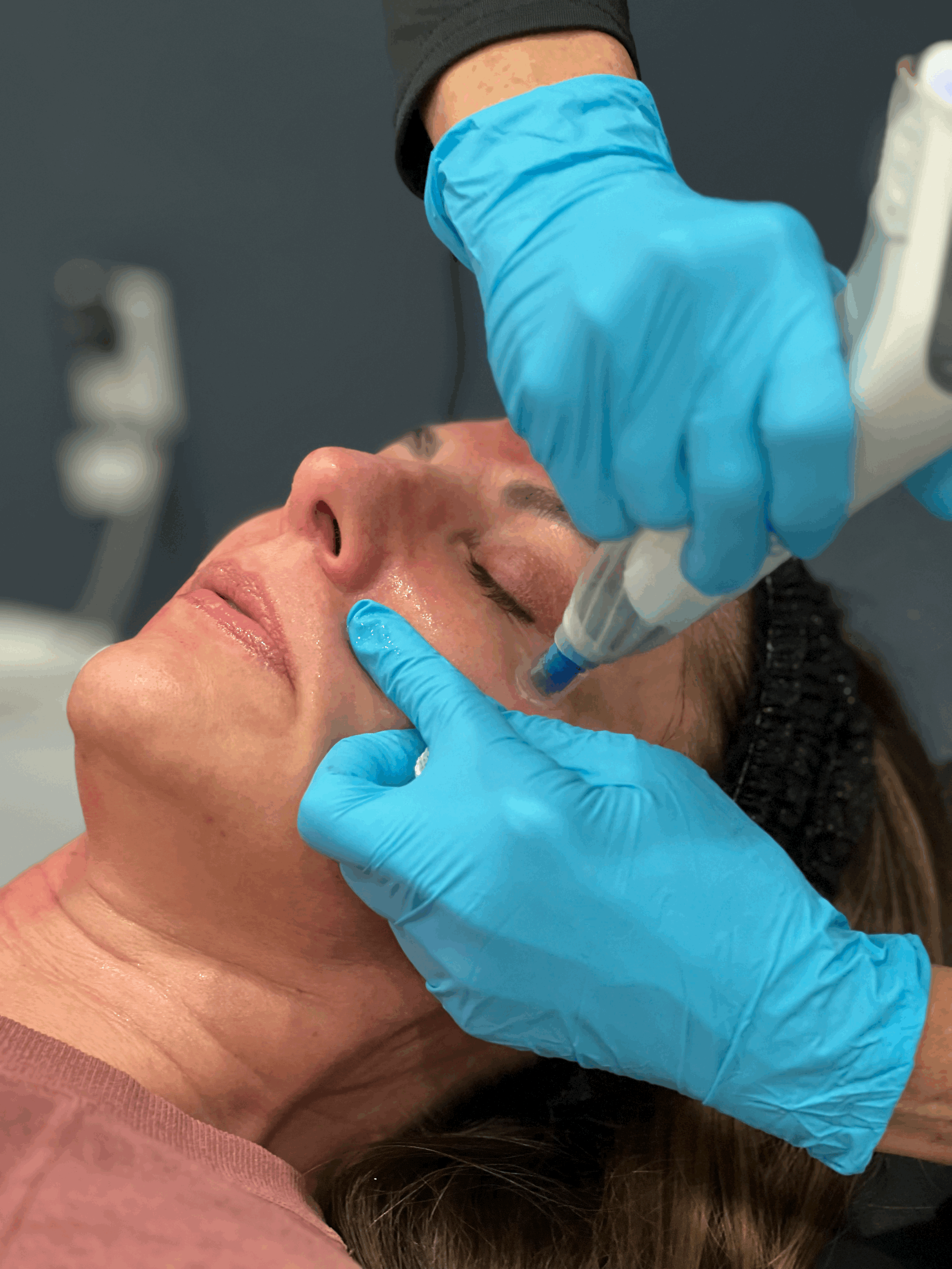 Aerolase® Neo Elite: A Calm Approach to Clear, Radiant Skin