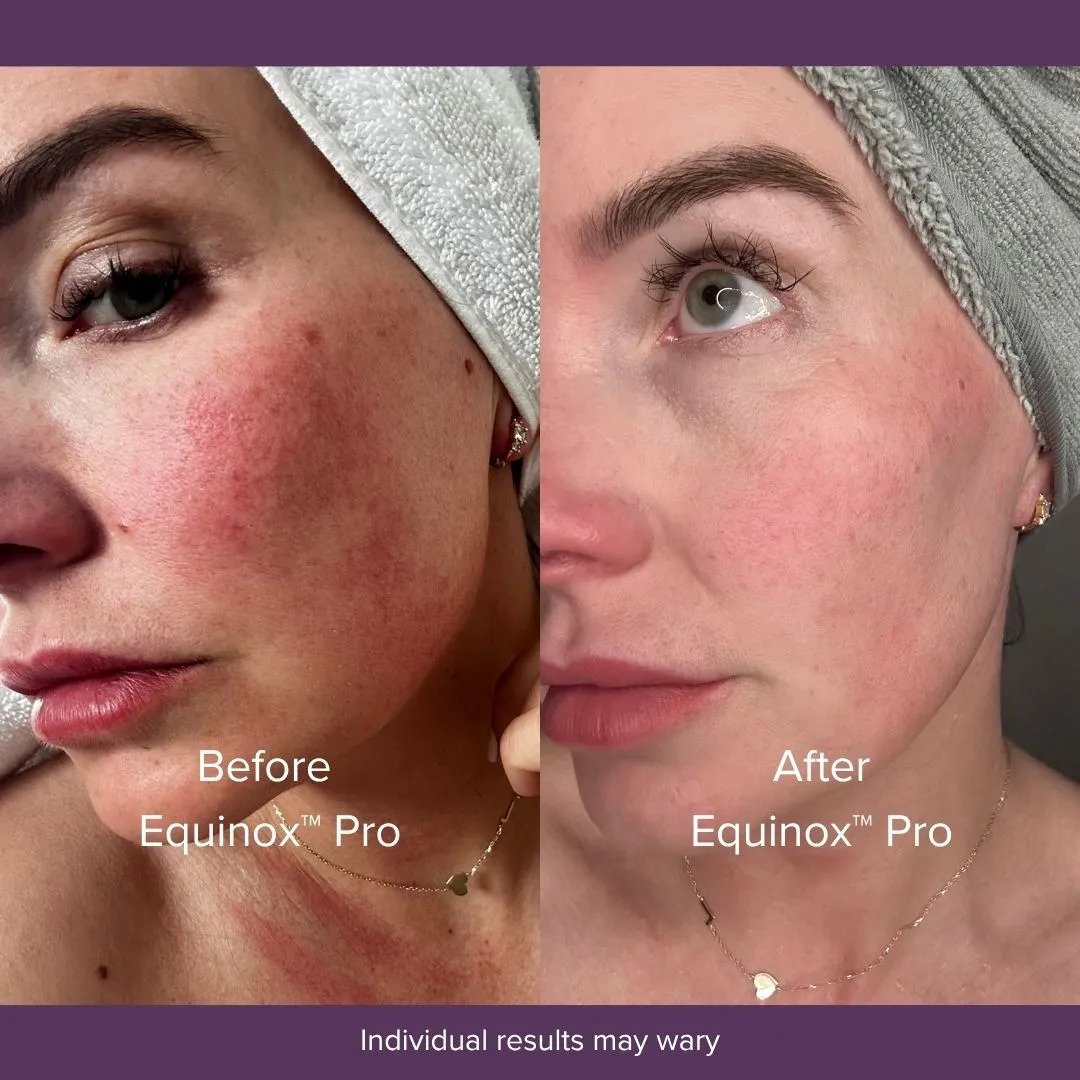 EquinoxProEffectiveBeforeAfters2.jpg