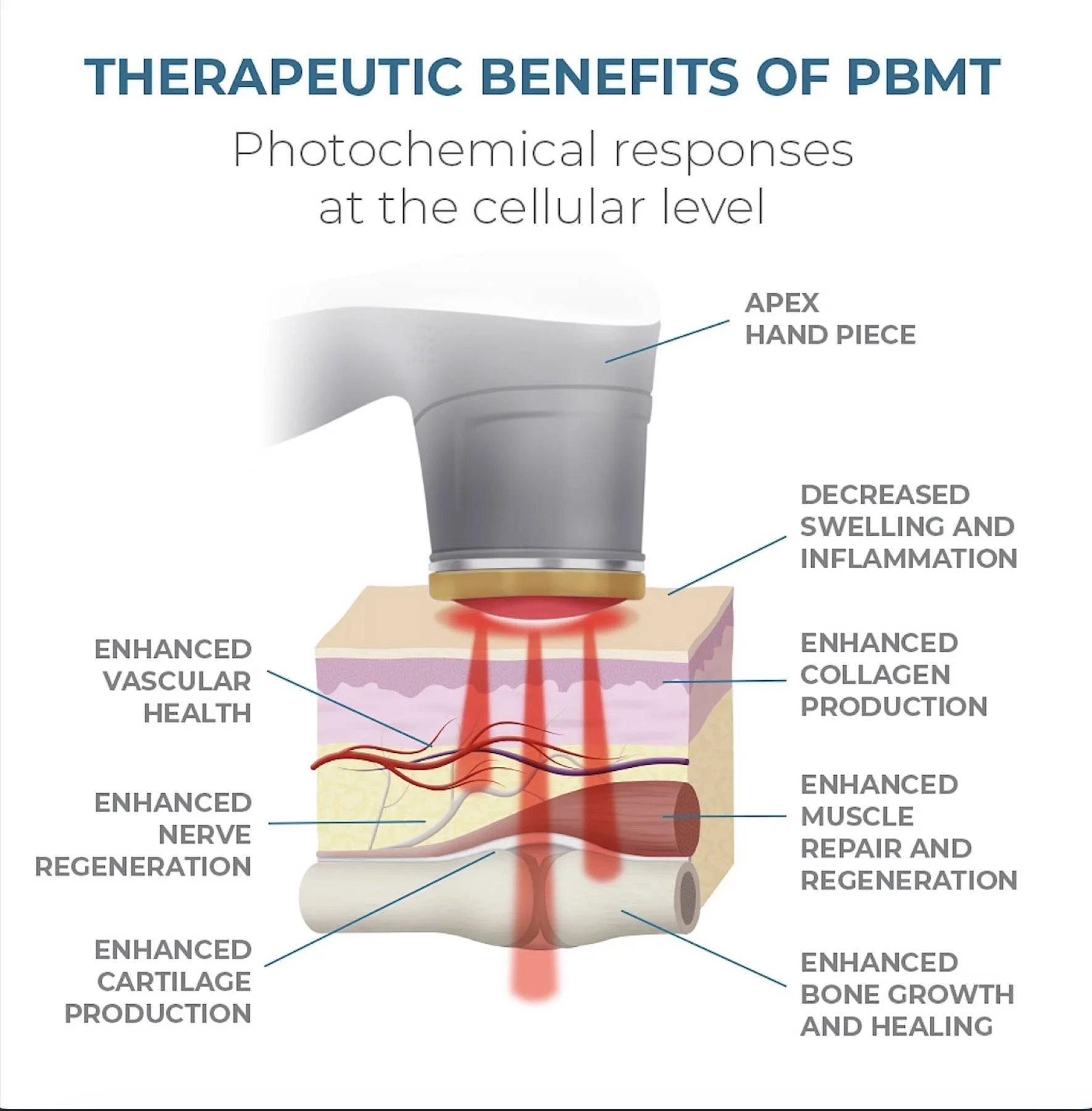 Infographic about the therapeutic benefits of photobiomodulation therapy aka laser therapy