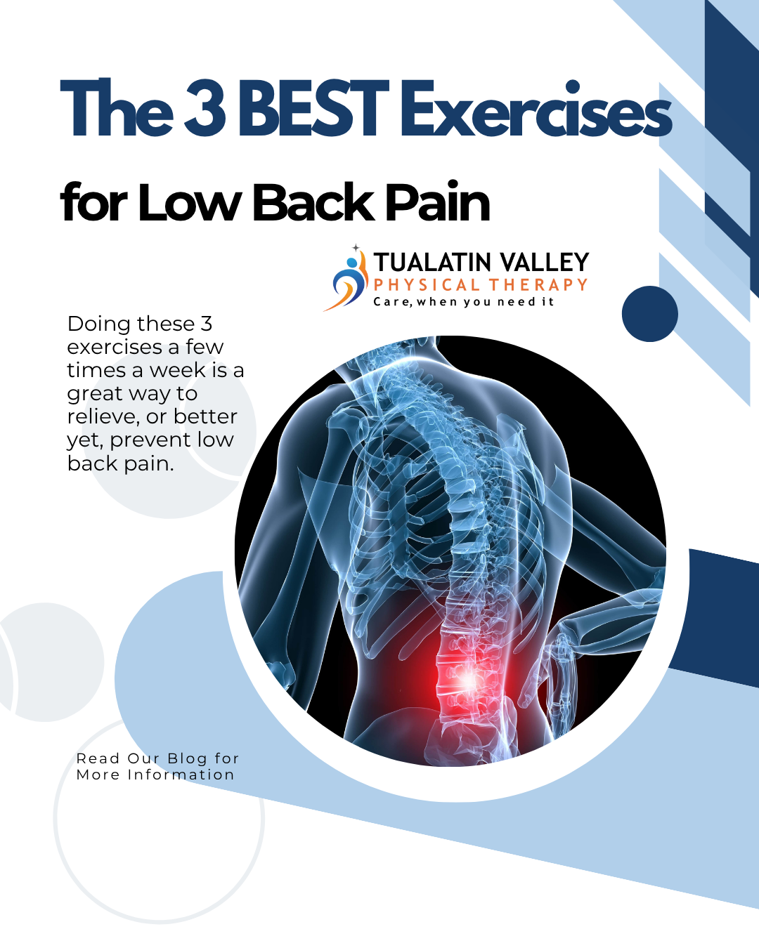 3 Essential Exercises for Lasting Low Back Pain Relief