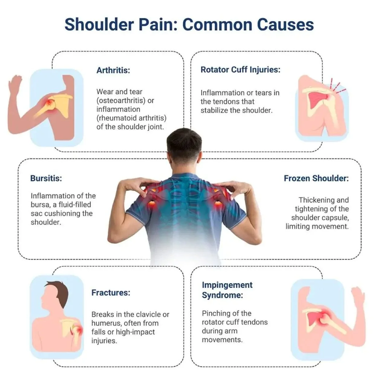 common causes of shoulder pain during bench press in Hillsboro, OR