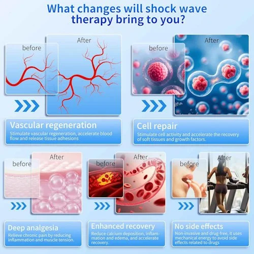 Learn more about the biological modulations that extracorporeal shockwave therapy can stimulate.