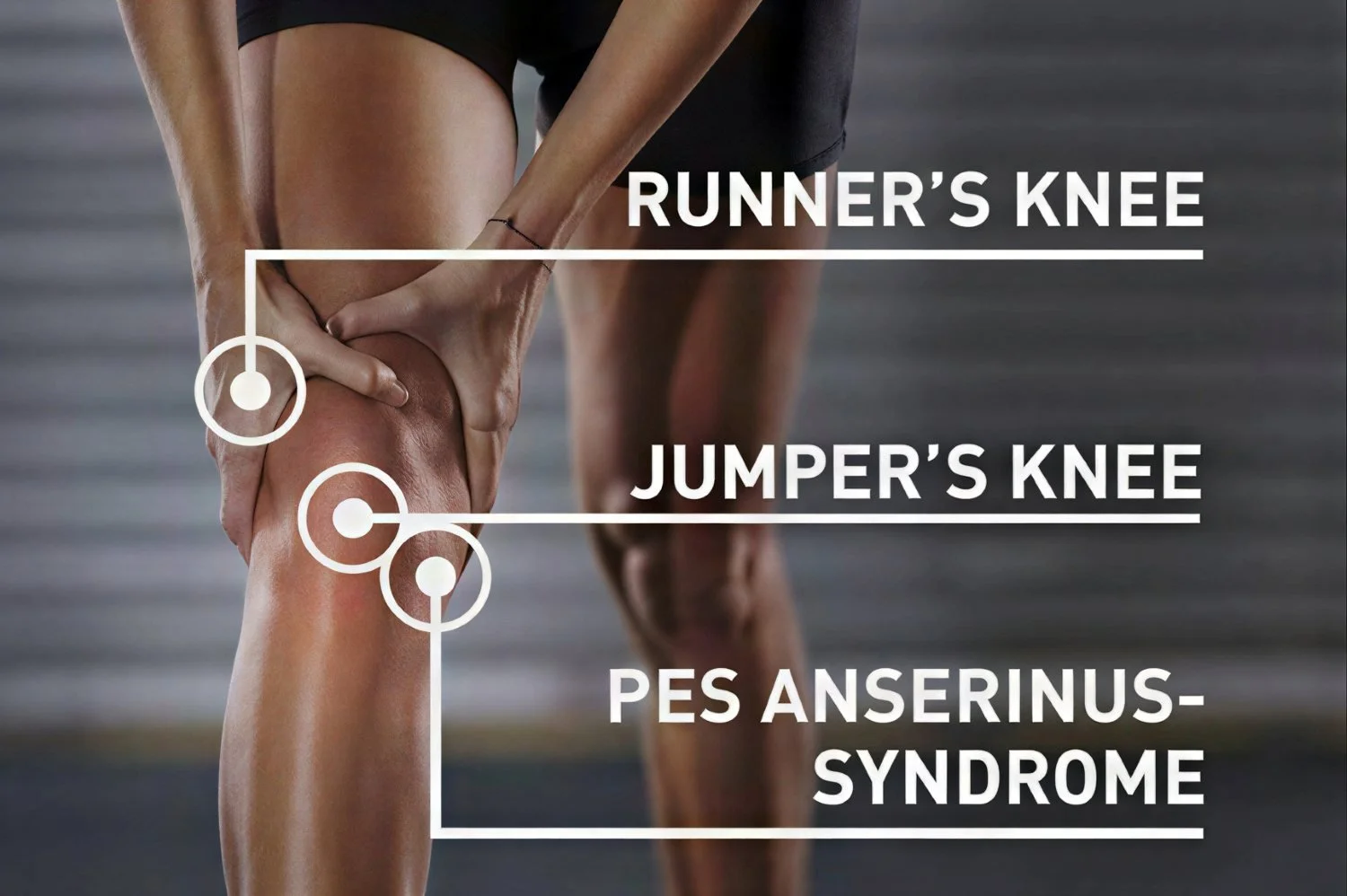 Picture showing typical pain areas for specific knee injuries