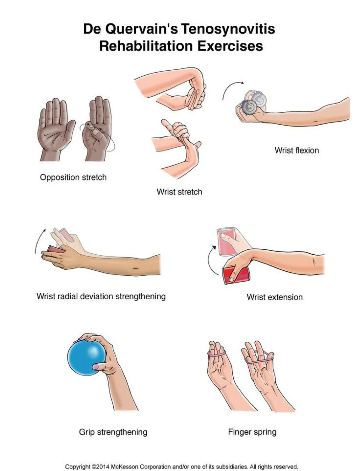 Rehab exercises to treat Mommy's thumb aka De Quervain's tenosynovitis