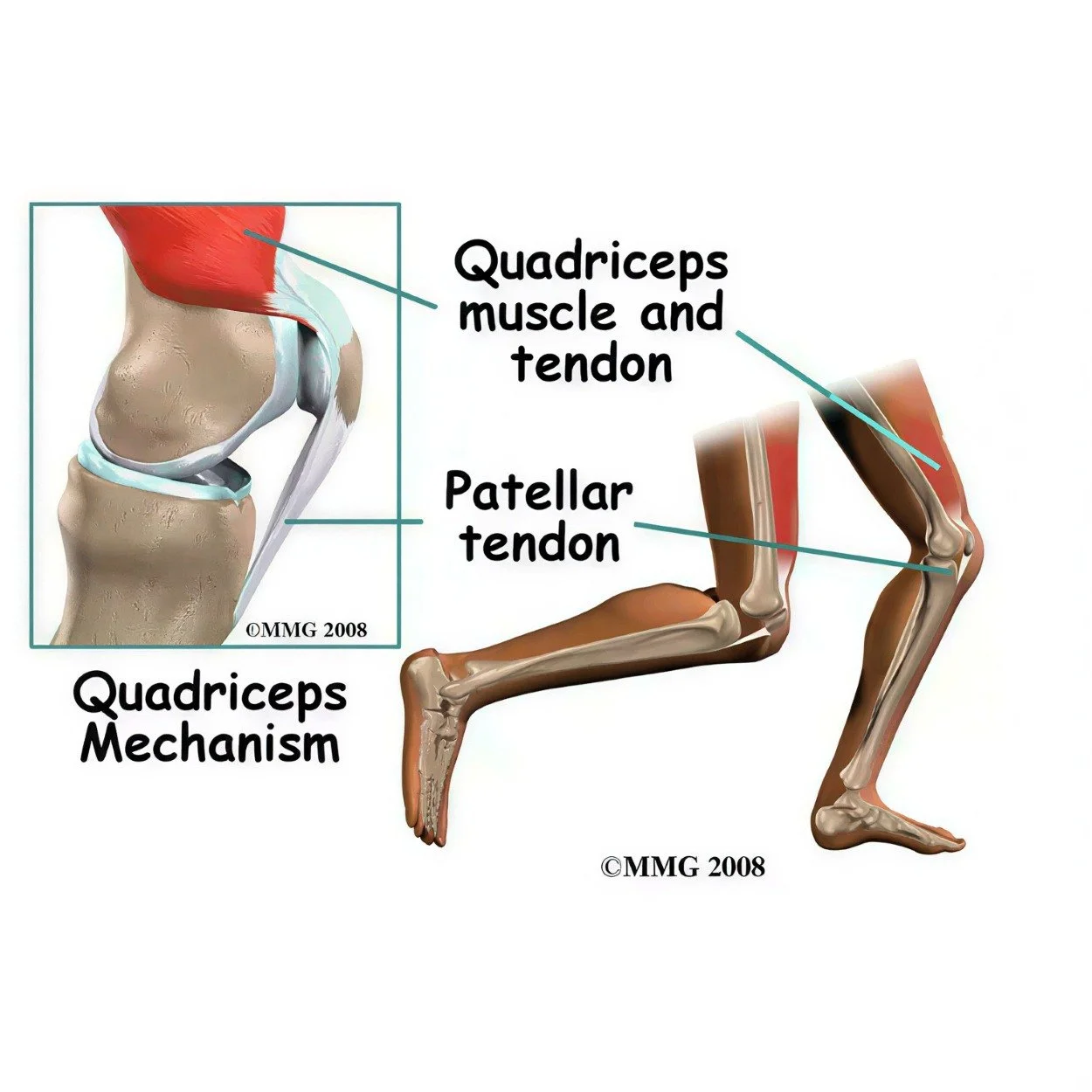 Patellar tendonitis physical therapy in Hillsboro, OR