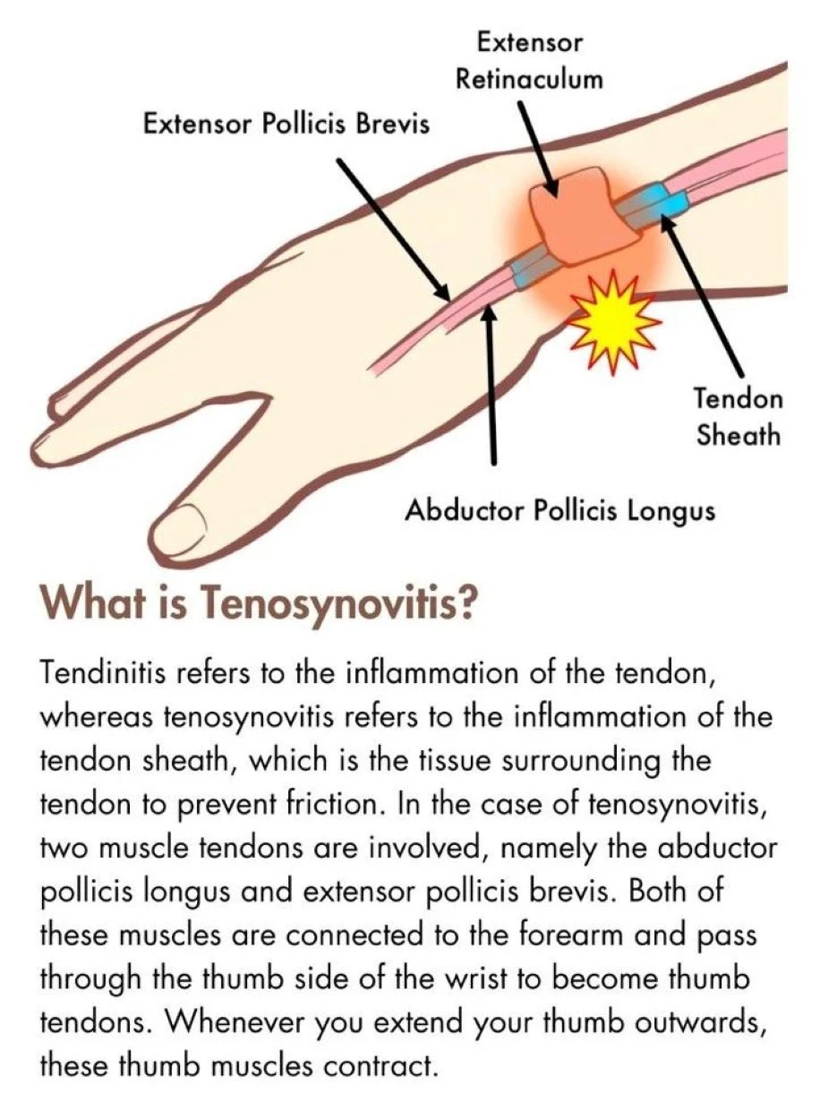 Image of the anatomy of thumb-side wrist pain and an explanation of tenosynovitis vs tendinitis.