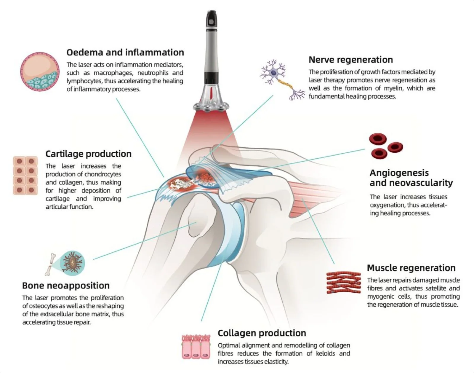 Infographic demonstrating the many positive effects that high-intensity laser therapy causes.