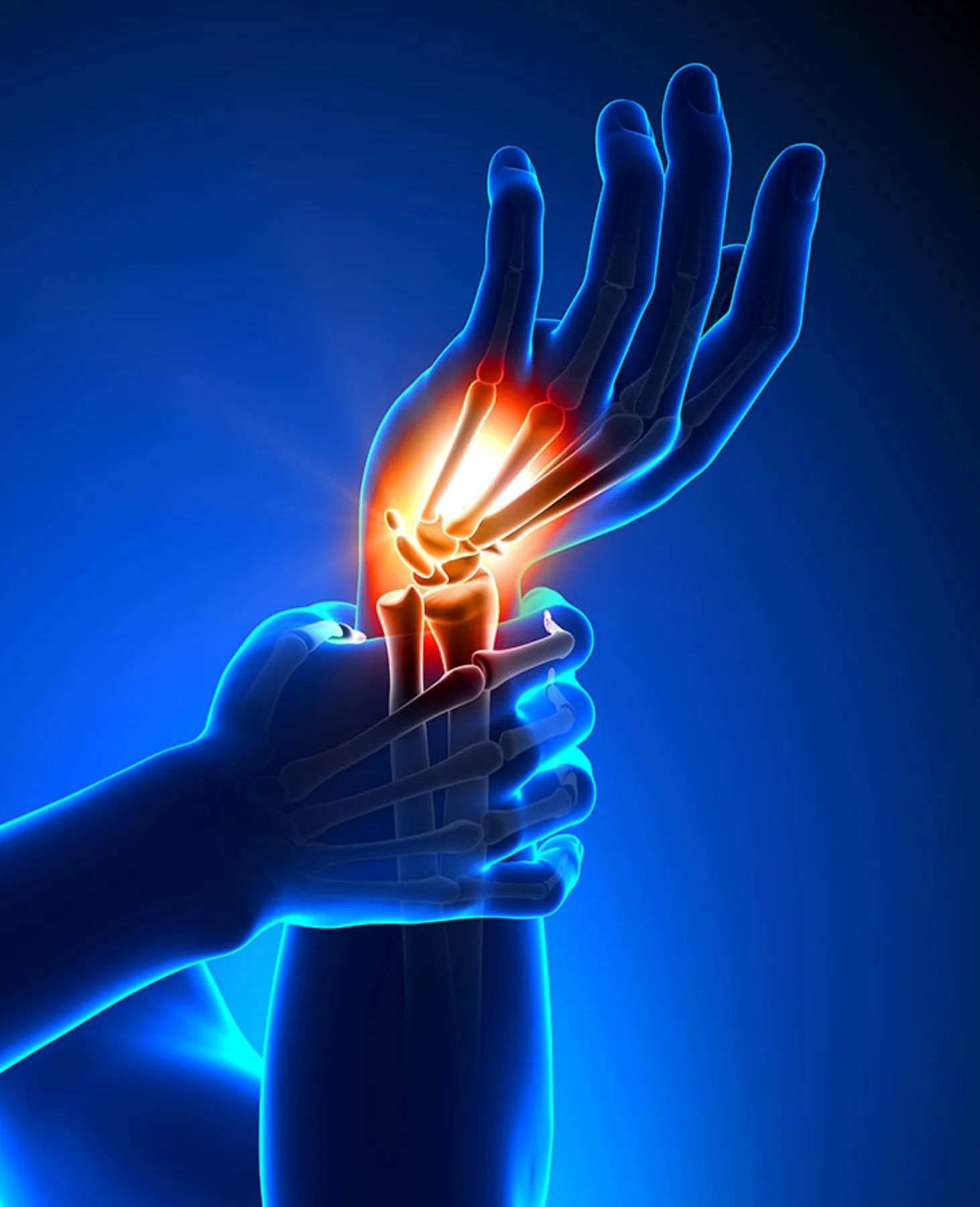 Graphic of hand and wrist pain