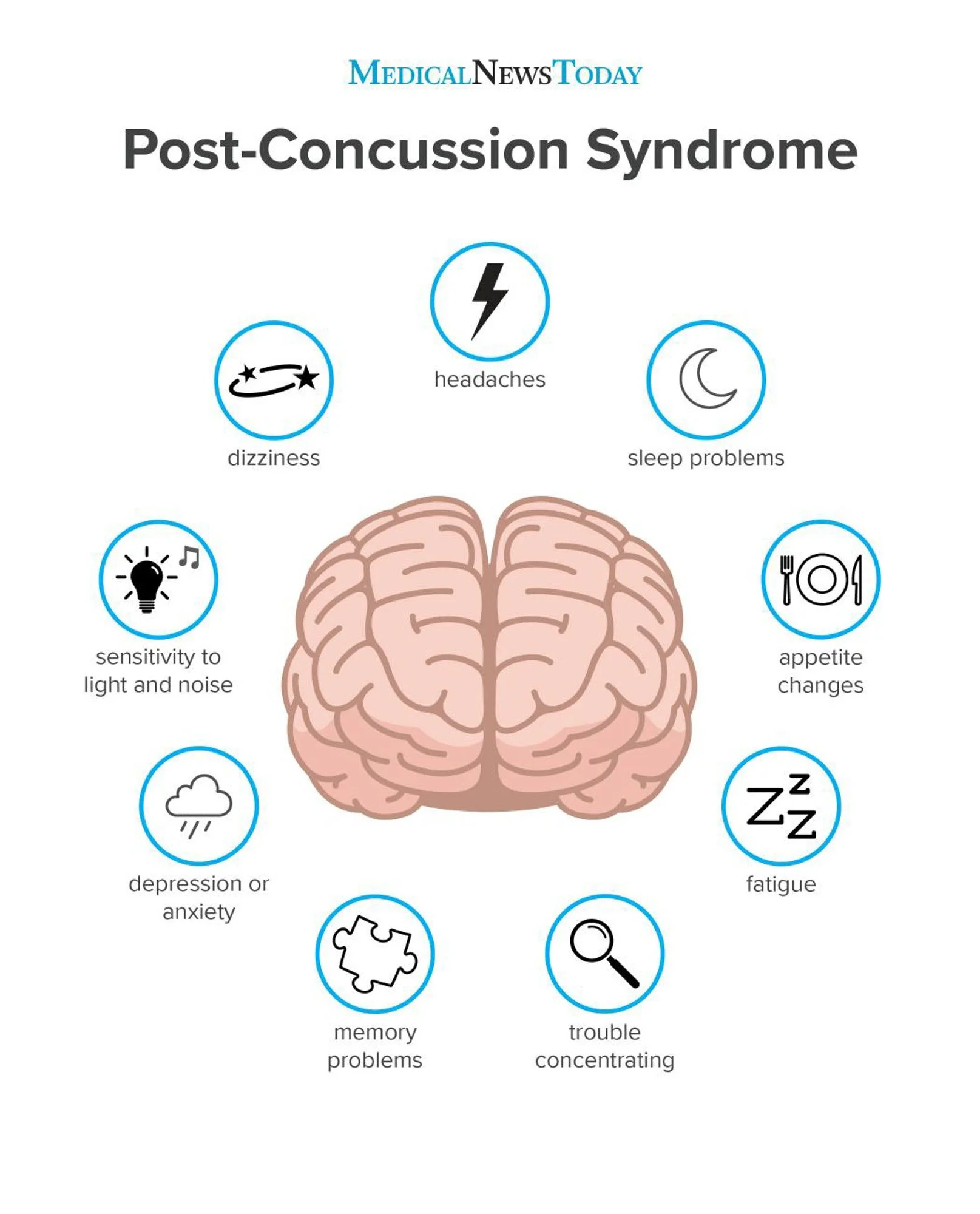 An infographic about post-concussion syndrome (PCS)  and related symptoms after a head injury.