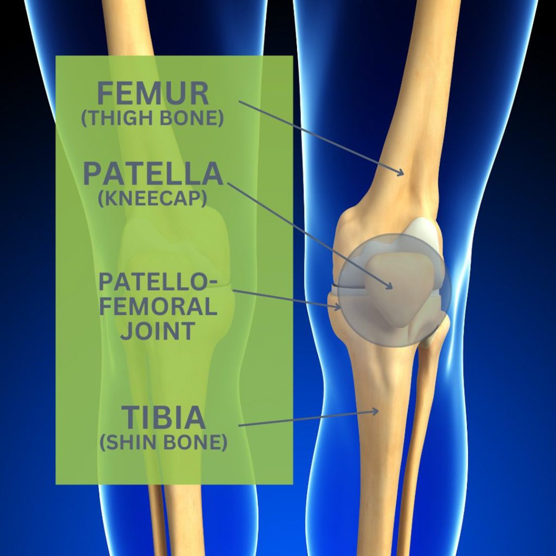 An image of the bones of the knee related to runner's knee pain