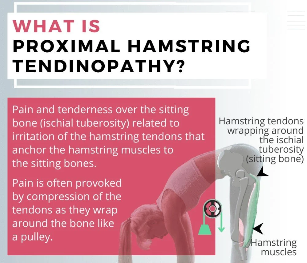 An infographic about what proximal hamstring tendinopathy is.