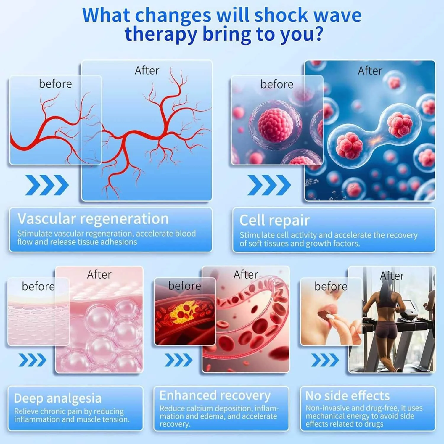 How shockwave therapy naturally enhances your healing process