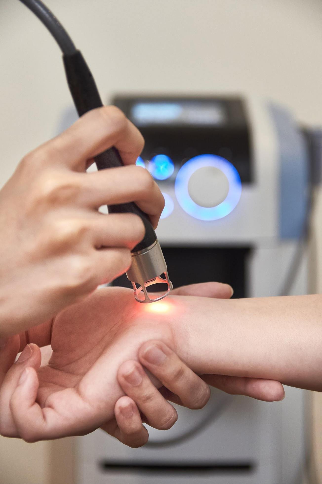 Class 4 laser therapy treatment for carpal tunnel syndrome (CTS).
