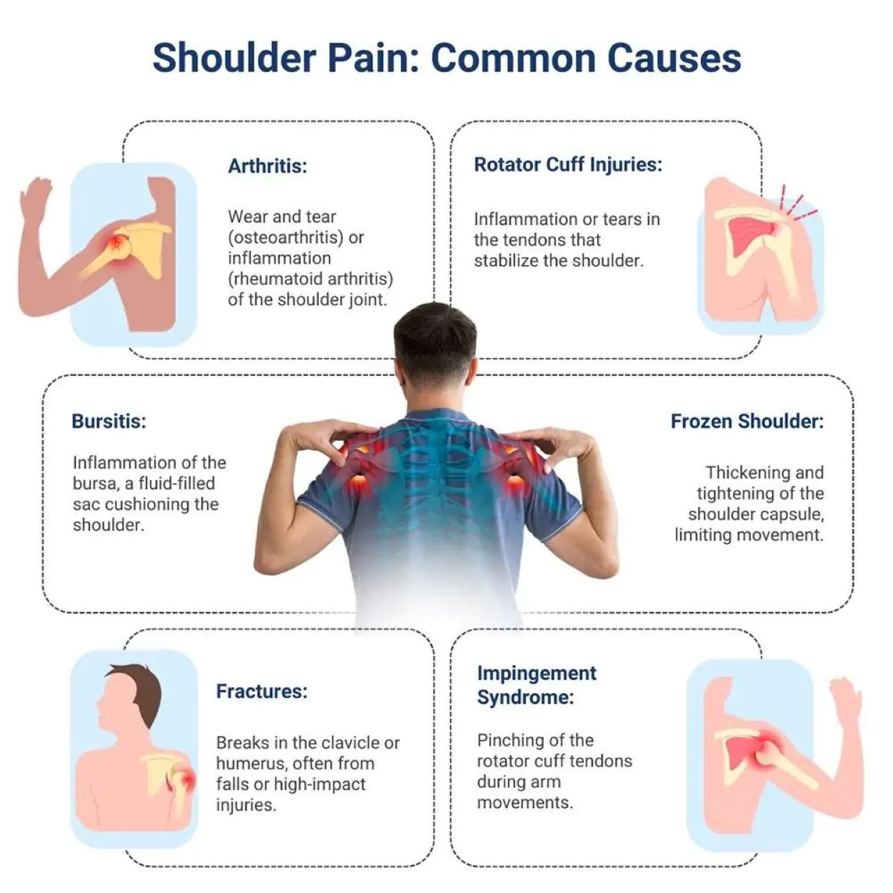Common causes of shoulder pain. Shoulder pain recovery in Hillsboro, OR.