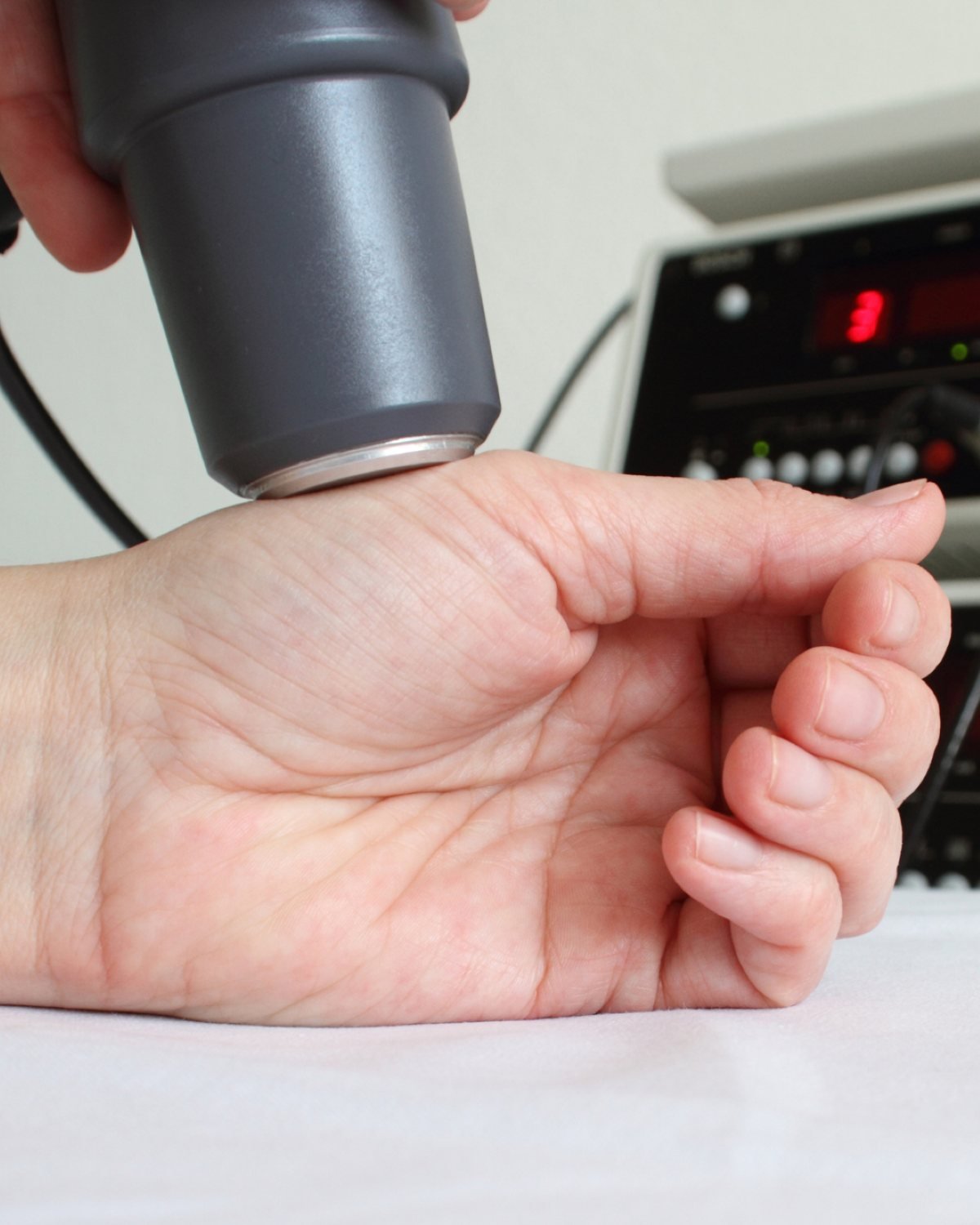 A photo of a patient receiving shockwave therapy De Quervain's Tenosynovitis treatment in Hillsboro, OR