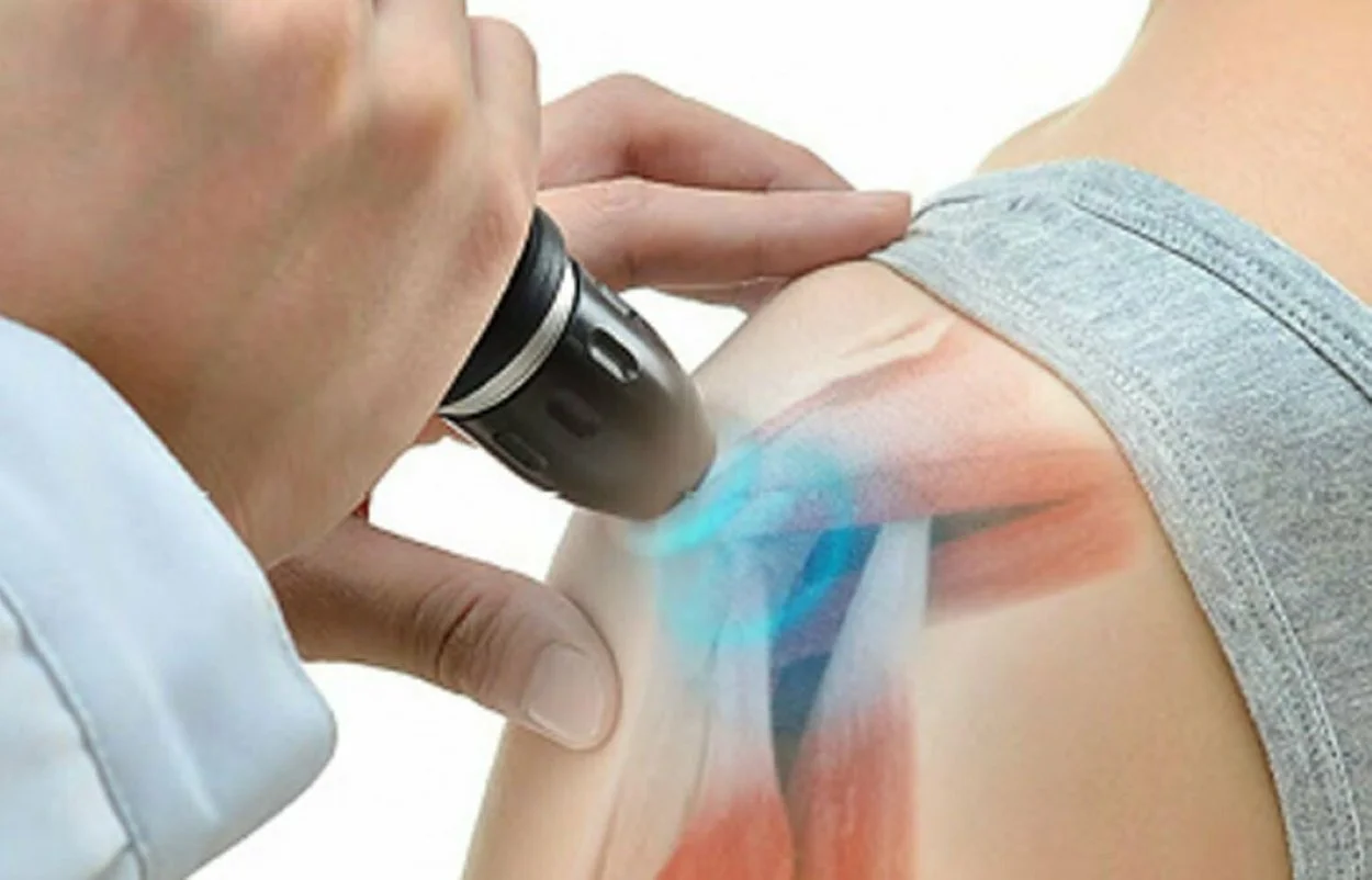 Shockwave therapy treatment of rotator cuff pain in Hillsboro, OR