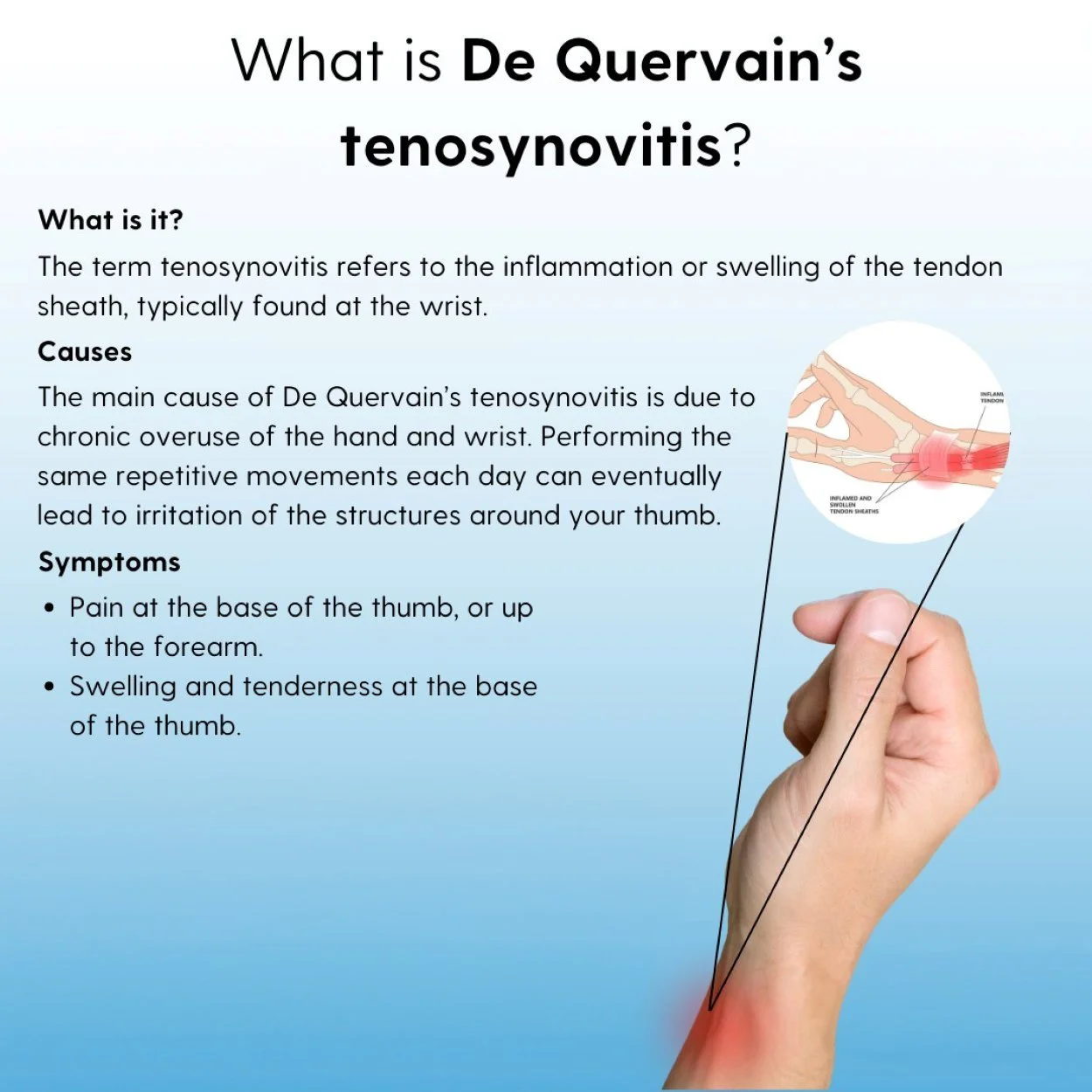 Infographic about what De Quervain's tenosynovitis is, common causes, and symptoms associated with thumb and wrist pain