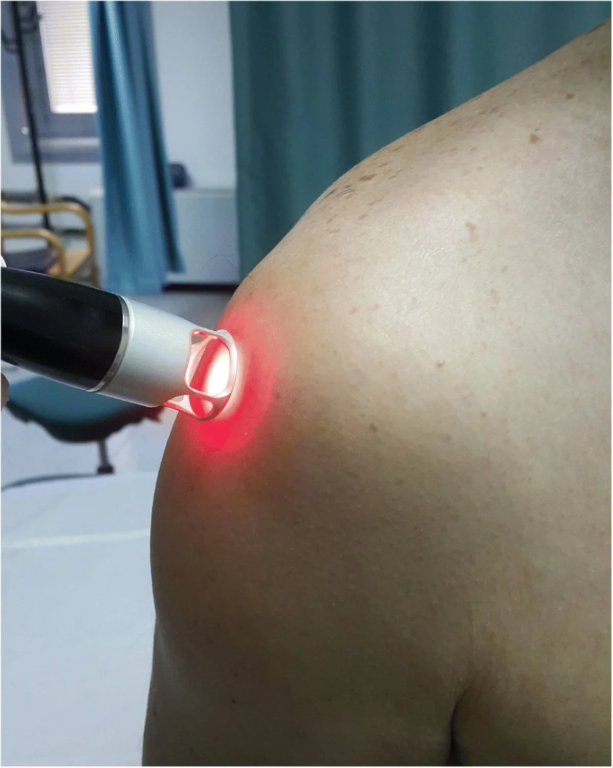 High-intensity laser therapy for shoulder impingement treatment in Hillsboro, OR