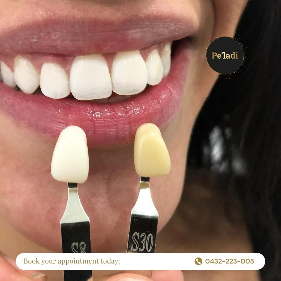 Another smile, another success story! ✨
We love seeing our clients walk out glowing with confidence &mdash; and nothing makes us prouder than knowing they&rsquo;re loving their results.

Whether it&rsquo;s your first visit or your fifth, we&rsquo;re 