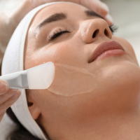 Chemical Peel