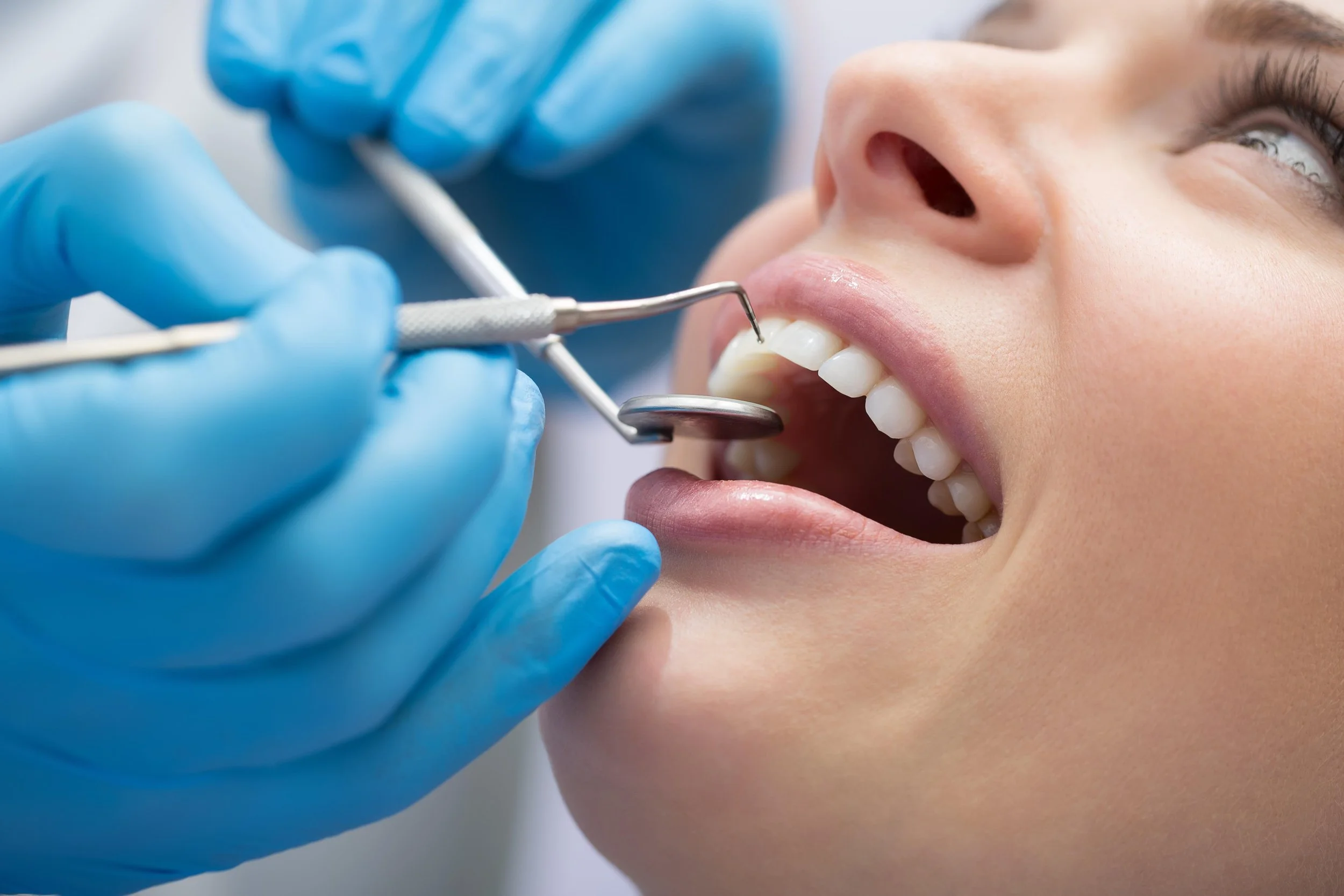 How Often Should You Visit the Dentist?