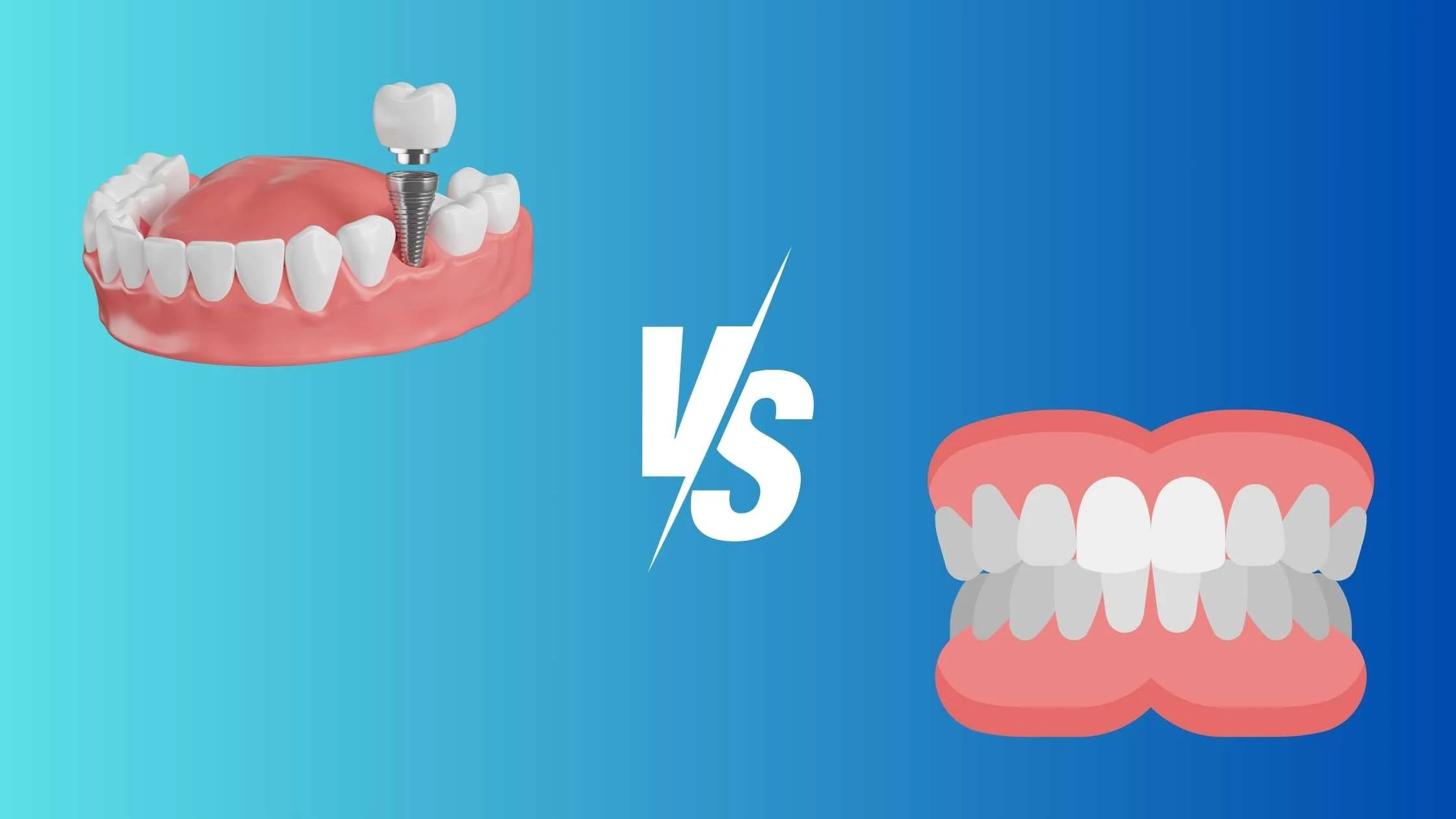 Dental Implants vs. Dentures: Which Is Better?