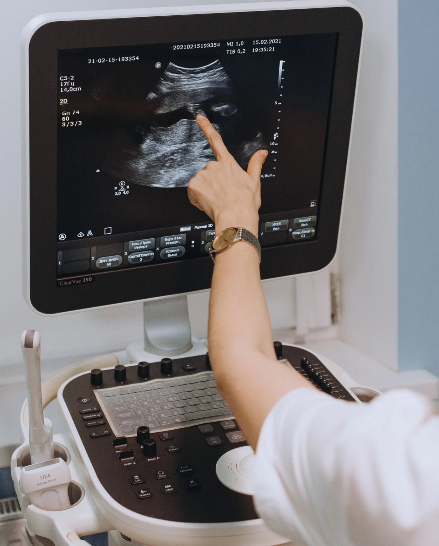 Vascular Ultrasound  (1).jpg