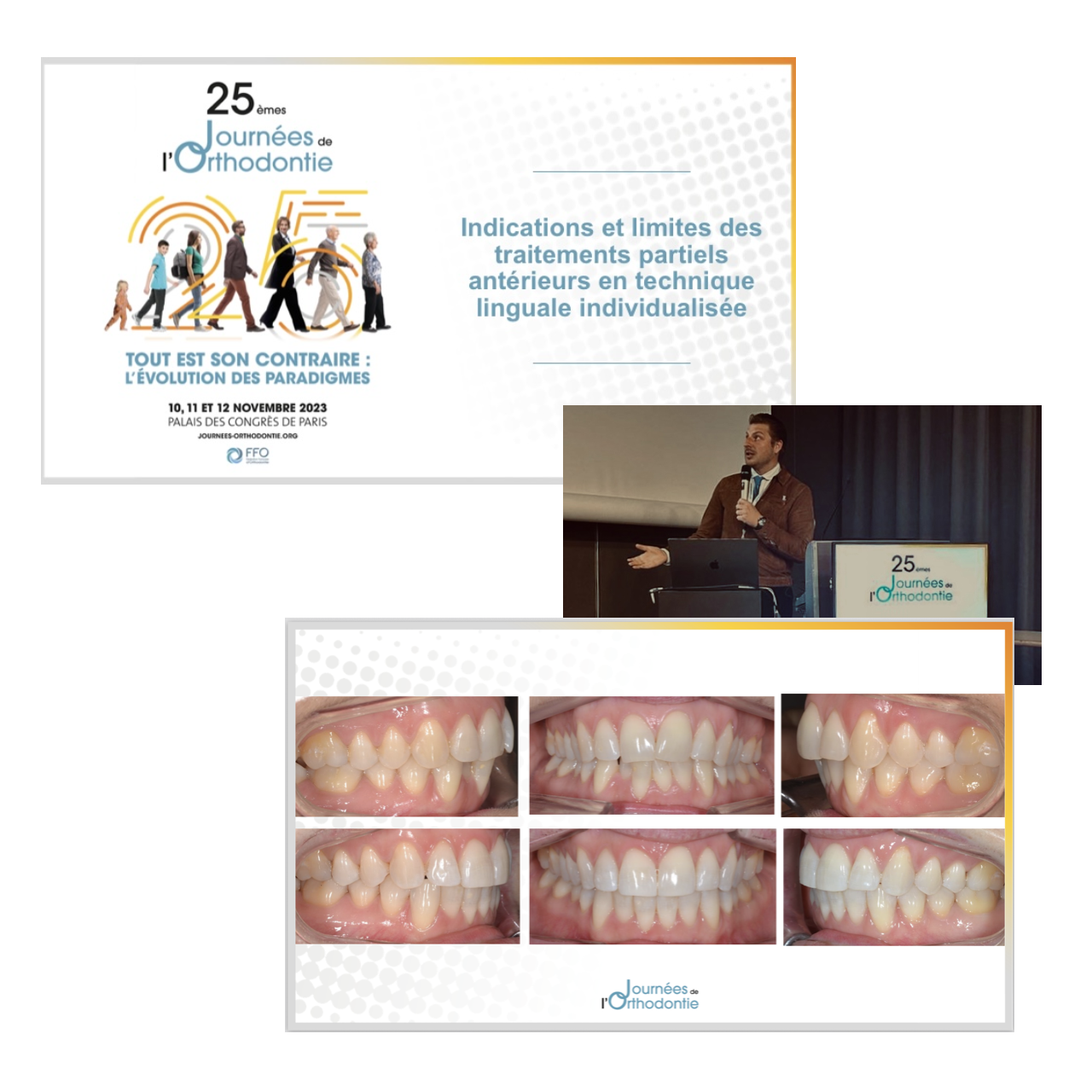 25èmes Journées de l'Orthodontie — Palais des Congrès de Paris Novembre 2023