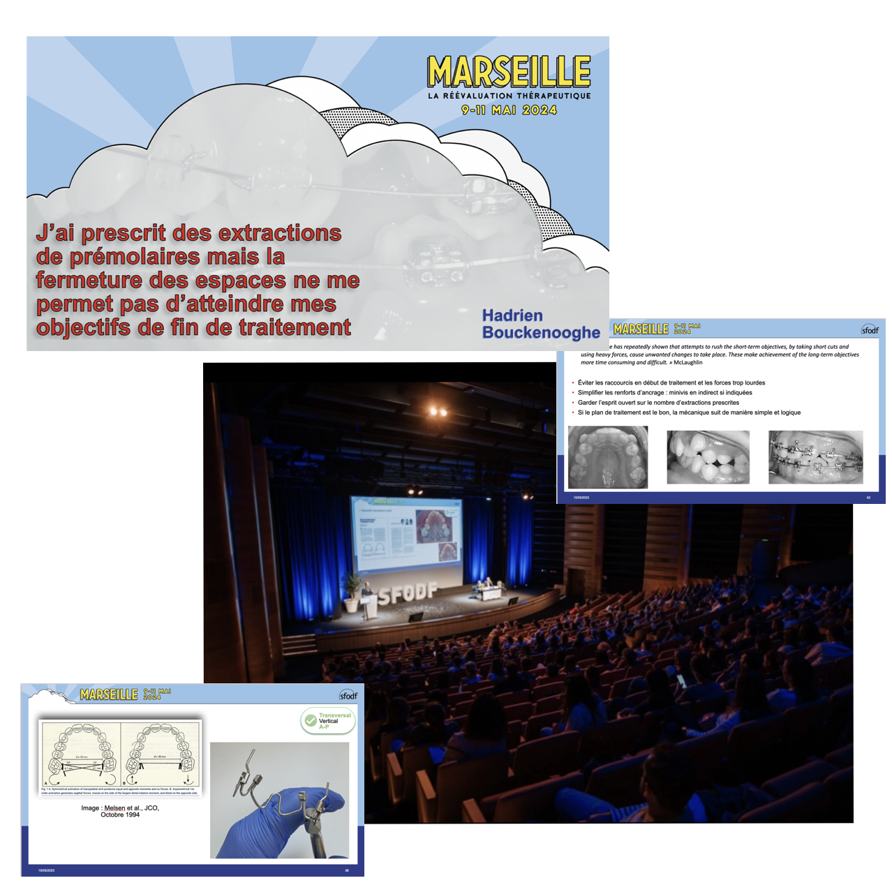 Congrès SFODF — Marseille, La Réévaluation Thérapeutique 9-11 mai 2024