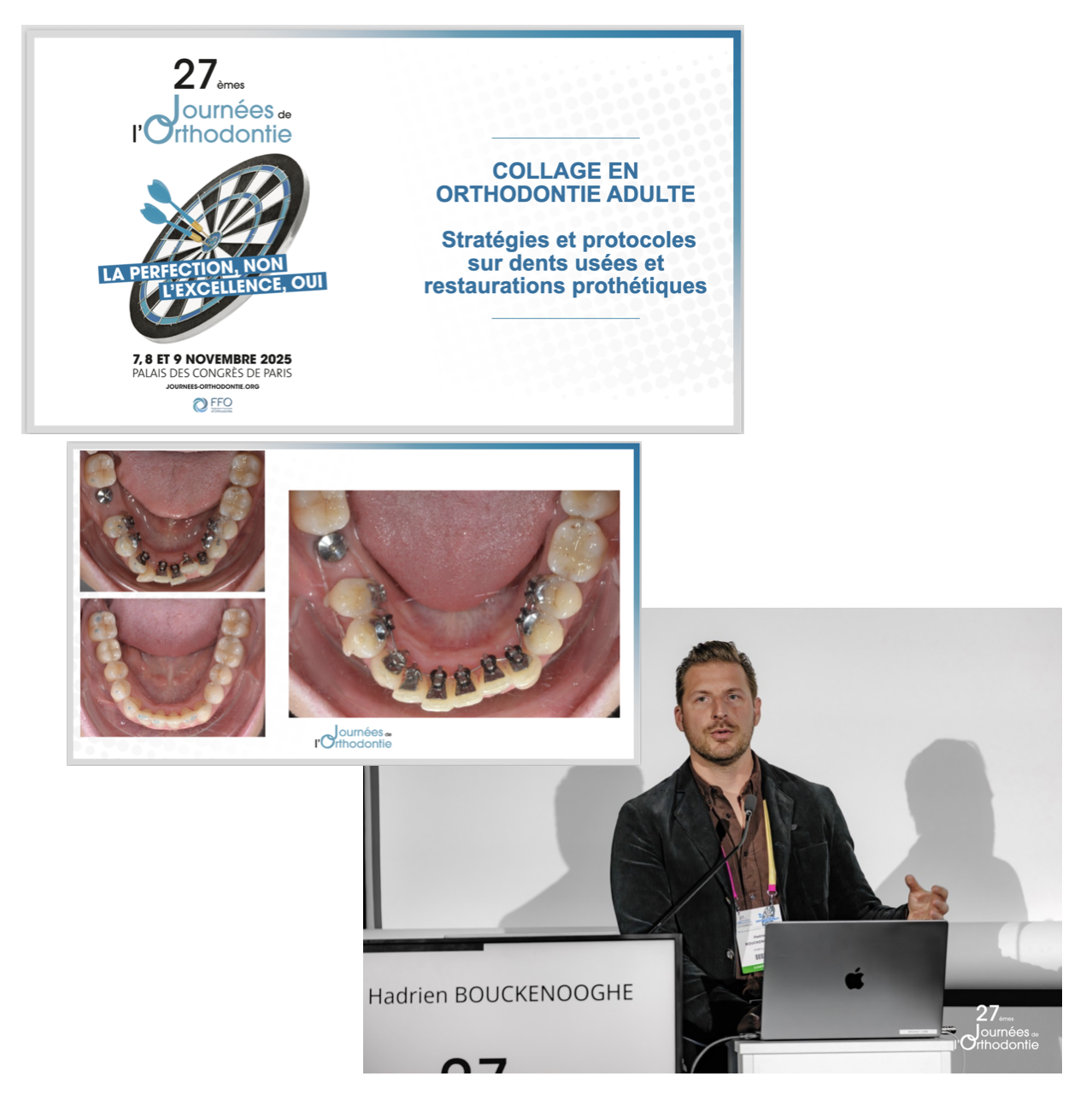27èmes Journées de l'Orthodontie — Palais des Congrès de Paris 7, 8 et 9 novembre 2025