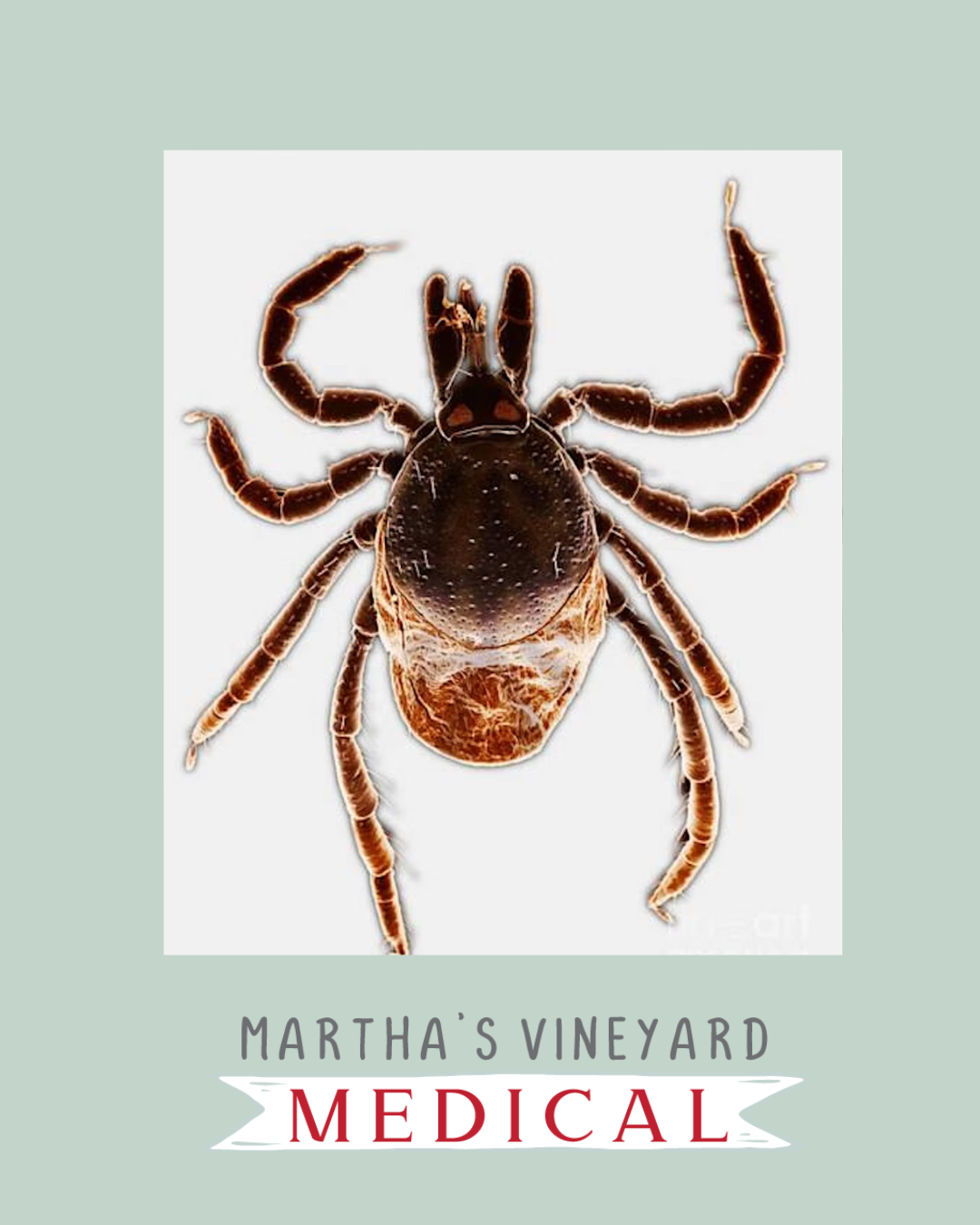 Tick Martha's Vineyard