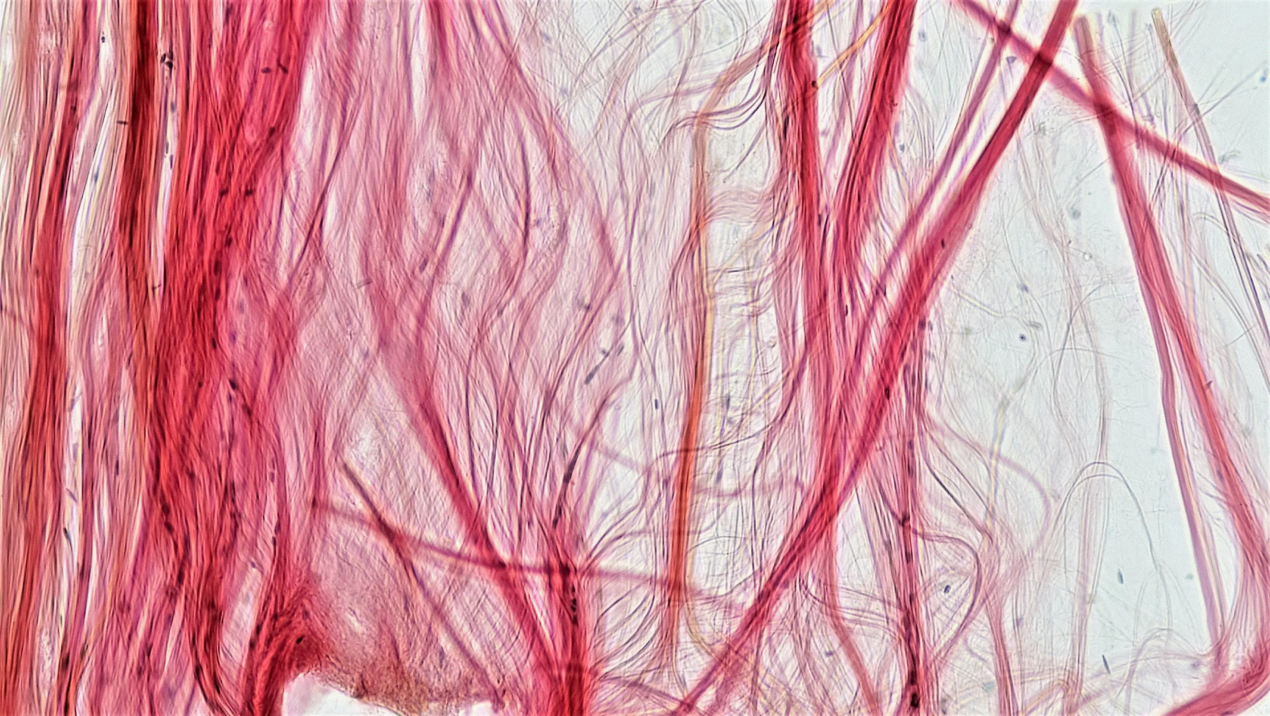Tendon Development in Childhood: The Case for Lots and Lots of Movement